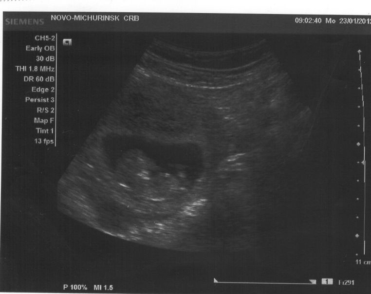 Дмитрий Есин фото №1